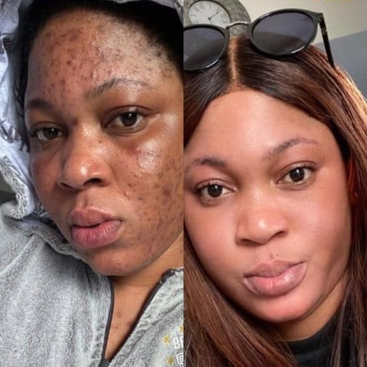 flawless skin